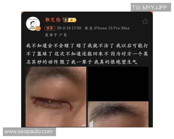 全是眼睛的篮球明星如何用视野和洞察力征服赛场与球迷心灵